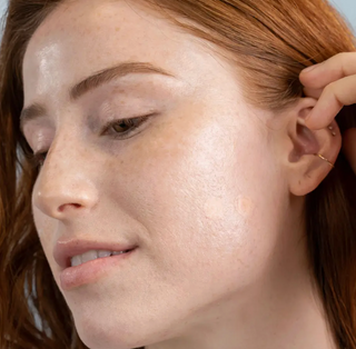 Dermadot Pimple Pad